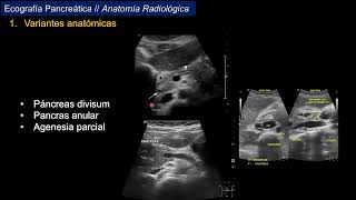 Ecografía Pancreática [upl. by Fabron]