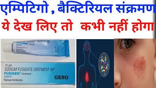 Fusigen Ointment sodium fusidate in hindi Use Profit Sideeffects by offlineboymedico [upl. by Accem]