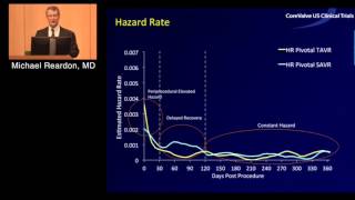 Transcatheter Aortic Valve Replacement Will Surgical AVR Disappear Michael Reardon MD [upl. by Collete918]