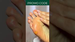 PEDICURE AT HOME for CRACKED HEELS Natural Products for Beginners  Men amp Women kit steps male [upl. by Matthiew]