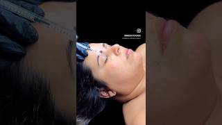 Microneedling microneedling microagujas limpiezafacialprofunda beauty retinol skincare [upl. by Orabelle]