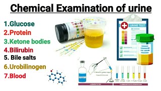 Chemical Examination of urine  Urine analysis  Glucose in urine  Glycosuria Explain in hindi [upl. by Jabez290]