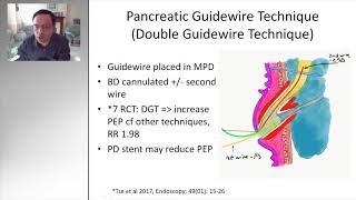 ERCP TIPS AND TRICKS DIFFICULT BILIARY CANNULATION  HiDef [upl. by Nnel]