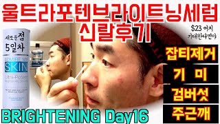 어드마이어마이스킨 DAY16 230짜리 아닙니다 기대를 낮춰야  울트라포텐브라이트닝세럼  Admire my skin ultra potent brightening serum [upl. by Zetes]