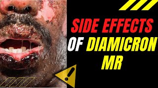 SIDE EFFECTS of DIAMICRON MR [upl. by Uzzia148]