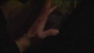 Mild hypokalemic periodic paralysis attack hand 20100113211503mpg [upl. by Nauqas]