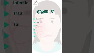 Know About Facial Nerve Palsy nerveloss facialnerveloss bellspalsy ghoshentfoundation ent [upl. by Hermie785]