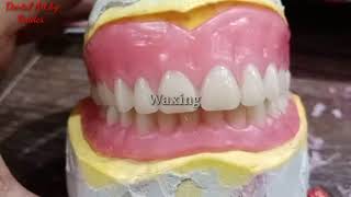 Wax up Carving and festooning of complete Denture  Waxing and carving of Complete Denture [upl. by Irolav74]