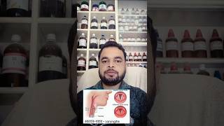 shorts cure  Laryngitis by Dr Deepak singh in prayagraj [upl. by Assenar]