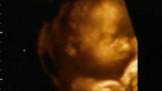 Our baby girl  28 weeks  3d ultrasound [upl. by Aihsot]