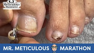 Deep Sidewall Cleaning Ingrown Prevention MrMeticulousMarathon [upl. by Ahdar]