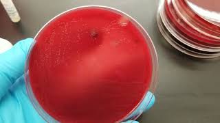 Microbiology Oxidase Test [upl. by Suzette216]