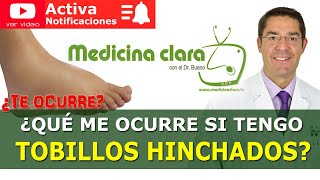 TOBILLOS HINCHADOS Dolor en los Tobillos Causas y soluciones  Medicina Clara [upl. by Analaj]