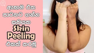 Try This Skin Peeling Treatment To Get Even Skin [upl. by Winonah]