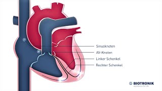 Elektrische Reizleitung des Herzens Animation Medizin [upl. by Enyawed3]