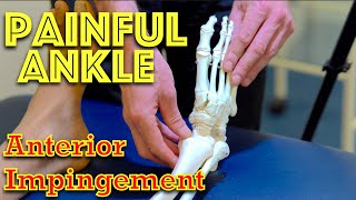 Ankle Pain  Anterior Impingement  Dr Gill [upl. by Einnalem225]