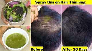 He Spray👆 this daily on Thinning Hair amp Bald AreasGot Thick Heavy Hair GrowthGet rid of Hair loss [upl. by Arahsak823]