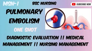 Pulmonary embolism part 2 [upl. by Carmel]