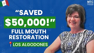 Full Mouth Implants in Los Algodones Mexico  Client’s Review [upl. by Kcerb861]