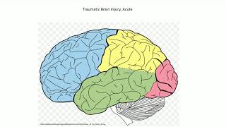 Acute Traumatic Brain Injury  Adventures in Neuropathology [upl. by Cindy]