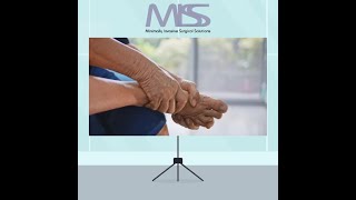 Plantar Fasciitis Relief Symptoms amp Treatments at MISS [upl. by Einnij584]