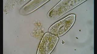 Paramecium Dividing [upl. by Christmann]