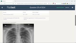 Pastest Online Question solvingSerially MRCP PartII Question 21 30 [upl. by Adnovad]