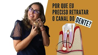 Retratamento de canal endodontia  Adornare Odontologia Estética [upl. by Bocaj]