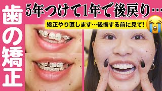 【矯正完成後】もう後戻りしてんけど😭！矯正やり直します…！経過報告 [upl. by Elleinnod920]