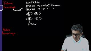 Clinical features of Intracerebral Hemorrhage Revision for FMGE NEET PG by Dr Deepak Marwah [upl. by Fiann778]