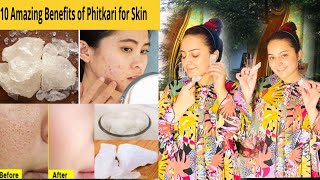 Phitkhari For Face Fitkari Se pimple Kaise HatayeFitkari Benefitshow To use phitkari👍 [upl. by Nylcoj783]