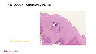 Lecture quotPlacenta 1 Histology Meconium and Inflammatoryquot [upl. by Easlehc73]