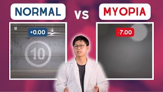 MYOPIA vs normal vision POV [upl. by Neenaj]