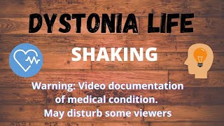 Paroxysmal Dystonia Daddy gets the shakes [upl. by Ragse]