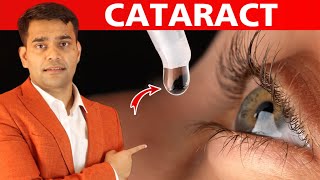 Eat This Every Day To Prevent Your Eyes From Cataract  Dr Vivek Joshi [upl. by Etnuahc973]