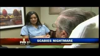 Dr Sandra Lee Talks Scabies Prevention on KTTV 012612 [upl. by Airamak]