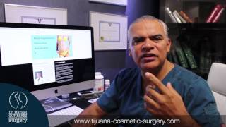 Rhinoplasty Surgery in Tijuana Mexico  Dr Manuel Gutierrez  Best Plastic Surgeon [upl. by Lais438]