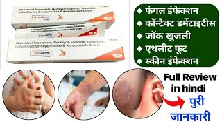 Tynoderm cream full review in Hindi  fivederm cream review in hindi  dermi 5 cream in hindi [upl. by Cayla268]