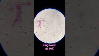 Ring Worm at 10X shorts [upl. by Aneed]