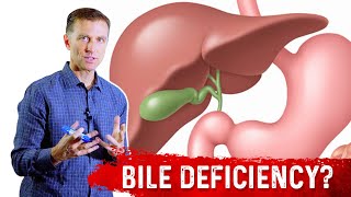 How To Know if You Have Bile Deficiency  Dr Berg [upl. by Rehpinnej]