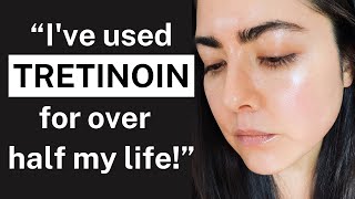 My 22YEAR Tretinoin Experience The Key to Youthful Skin for Over 2 Decades [upl. by Lerat]