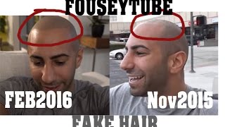 FouseyTUBE Fake Tattooed Hair  How He Got New Perfect Hairline [upl. by Livy]