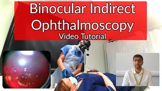 Binocular Indirect Ophthalmoscopy Tutorial [upl. by Nyliram]