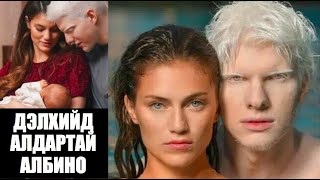 📌Дэлхийд алдартай ALBINO хүн… Яг л ANGEL шиг 46 [upl. by Gabrielle]