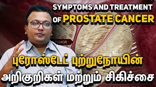 Prostate Cancer Symptoms amp Breakthrough Treatments  Onco Doctor Tamil Dr Dayananda Srinivasan [upl. by Preiser]