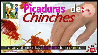 🕷️🐛 Picaduras de chinches  Piquetes de chinches  Como eliminar chinches de la cama picaduras 🛏️ [upl. by Tserof]