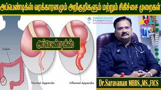 Home remedies for yeast infections in men in Tamil  Rahul Tamil Men Health tips [upl. by Windy]