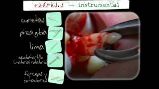 Instrumental y Esterilización en Cirugía Bucal [upl. by Atinad94]