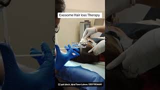 exosome hairloss exosomes hairfall hairfallcontrol hairlosstreatment bestdoctor drasifrauf [upl. by Diann357]