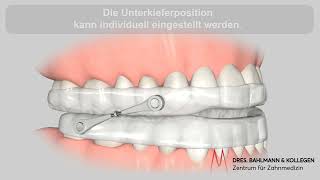 Schnarchschiene Köln  Funktion einer AntiSchnarchschiene [upl. by Yellah]